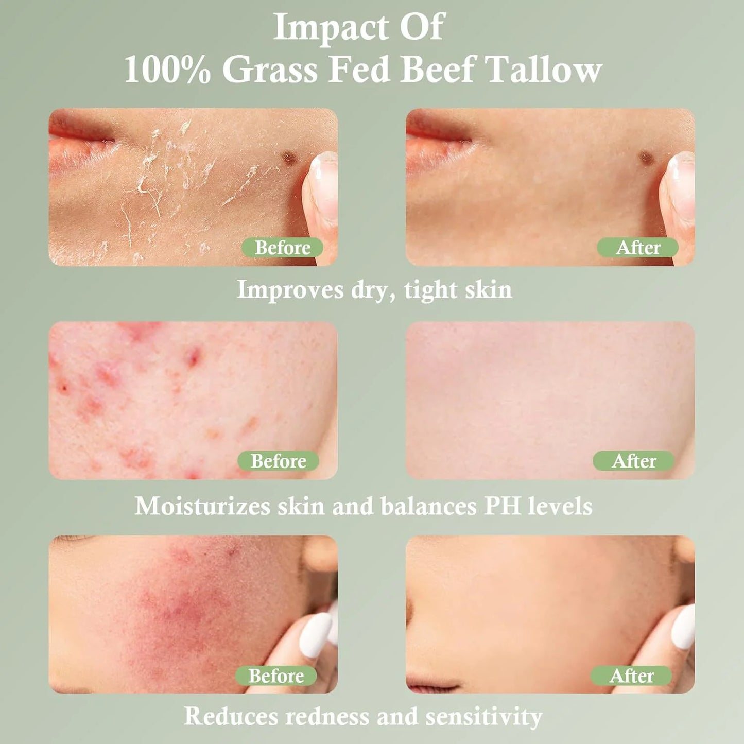 Grass-Fed Tallow Moisturizing Cream - Natural Skin Balm for Deep Hydration