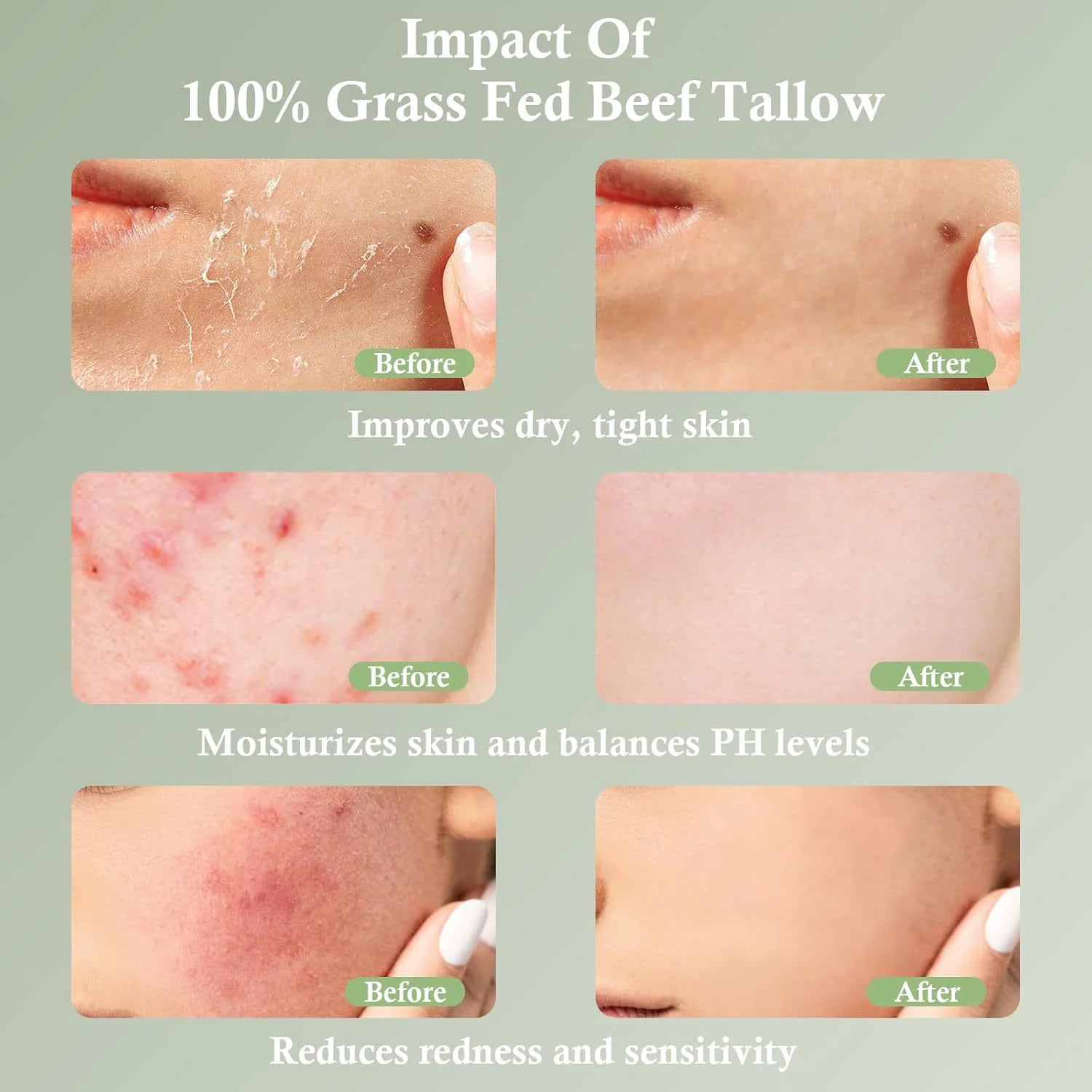 Grass-Fed Tallow Moisturizing Cream - Pure Skin Hydration