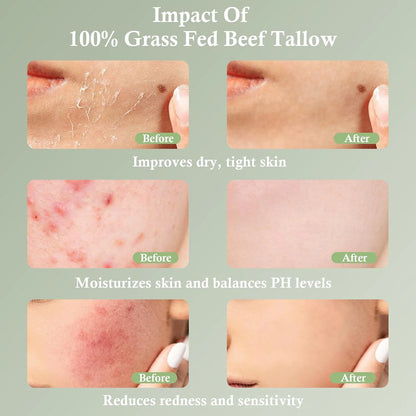 Grass-Fed Tallow Moisturizing Cream - Natural Skin Balm for Deep Hydration