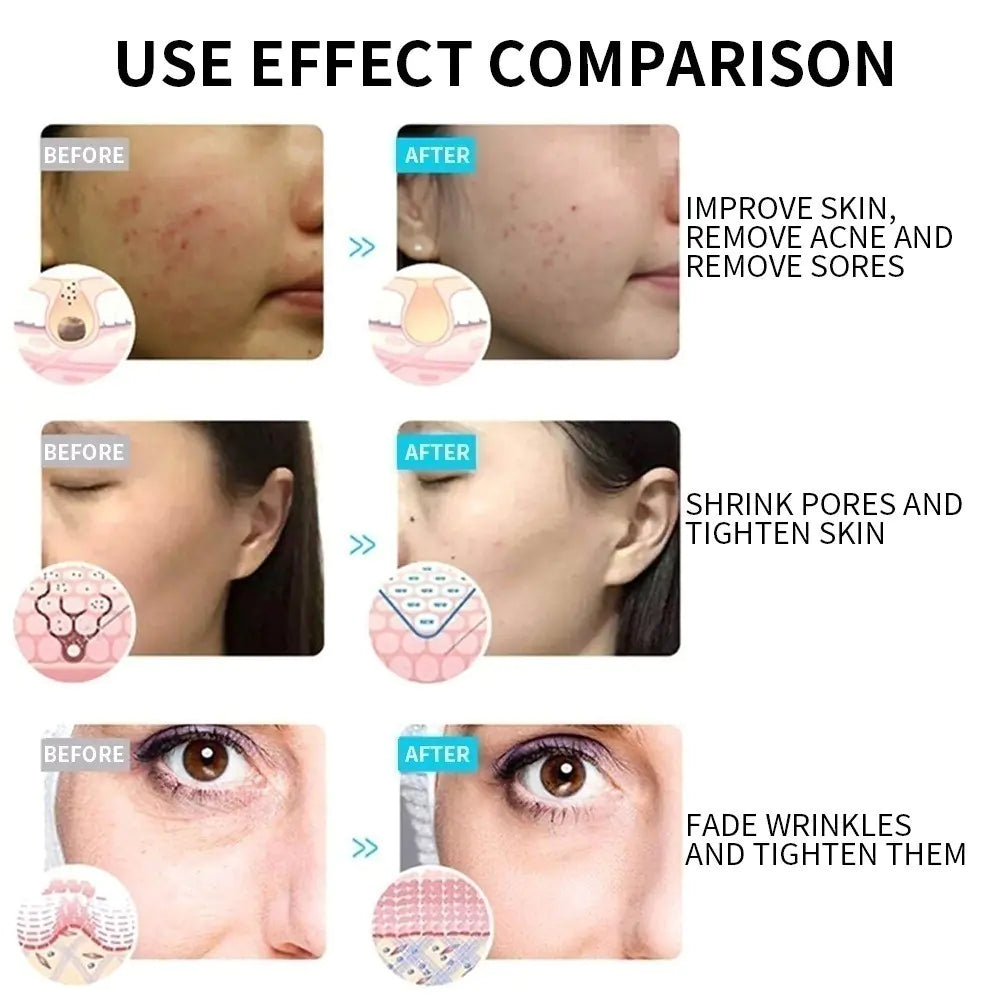 LED Light Therapy Face Mask - 7 Colour Photon Skin Rejuvenation Device