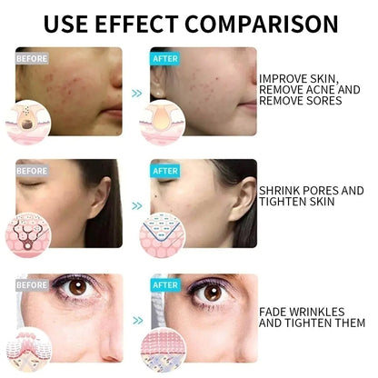 LED Light Therapy Face Mask - 7 Colour Photon Skin Rejuvenation Device
