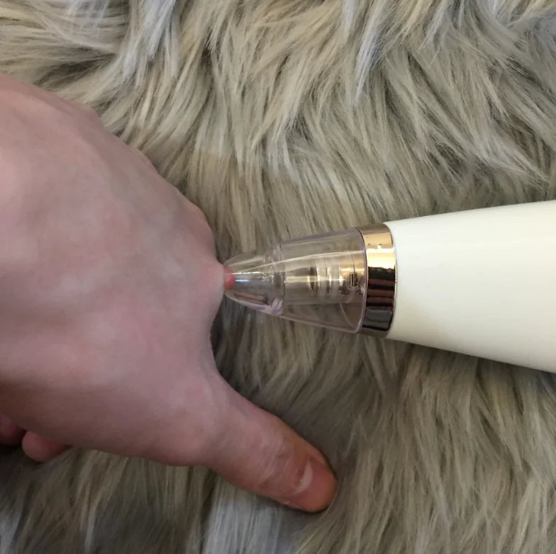 Blackhead Remover Vacuum - Pore Cleaner &amp; Suction Tool